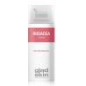 Rosacea cremeNieuw standaard8717953143174